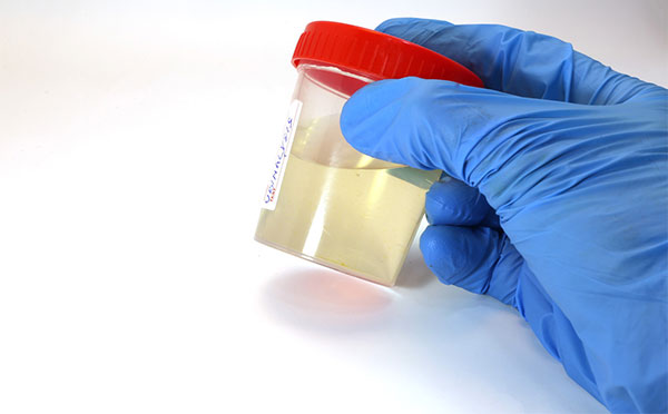 hcgֵ�����ǻ��� hcgʲôʱ����